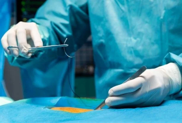 Fistula Surgery
